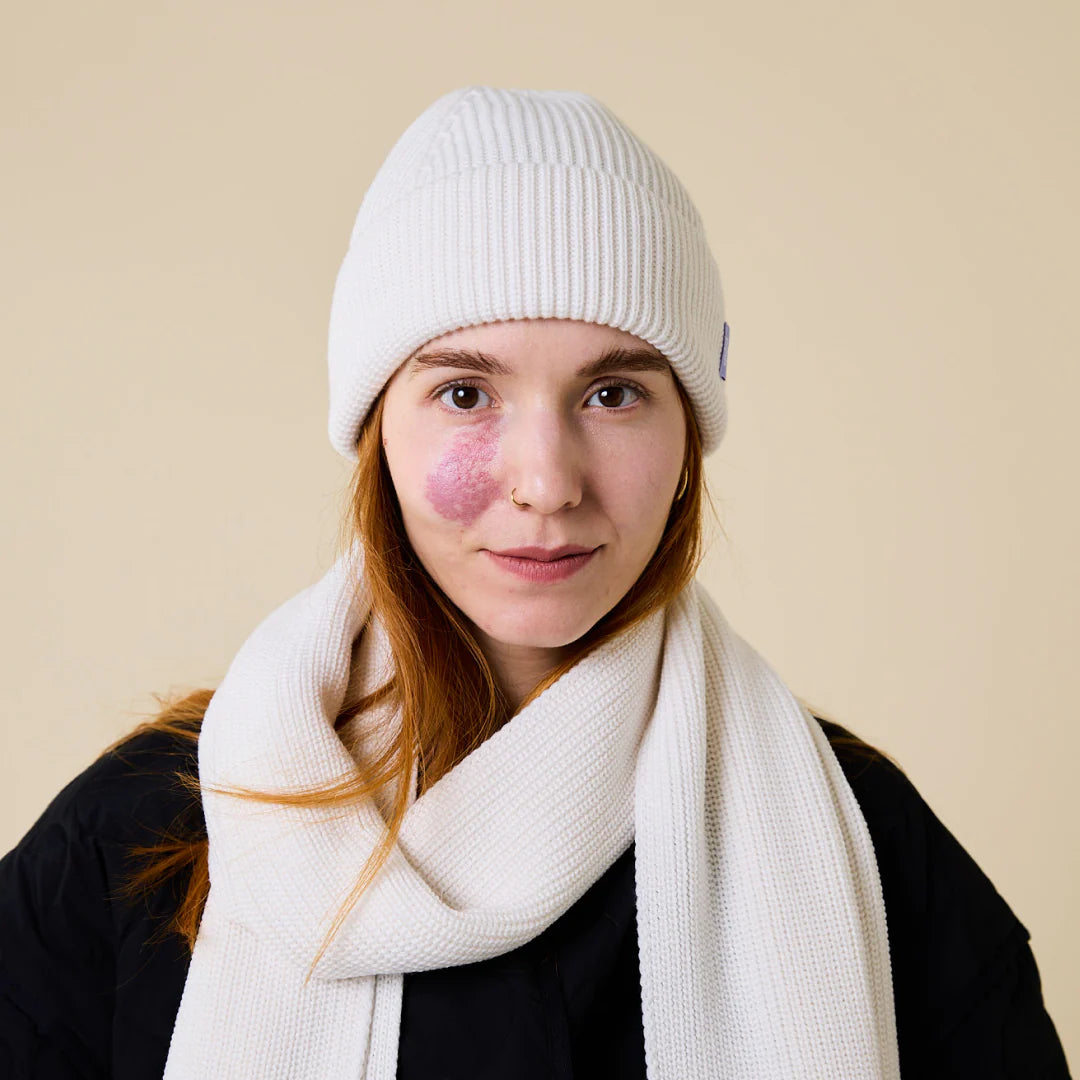 Eine Frau mit glattem rötlichem Haar trägt eine weiße Strickmütze und einen passenden Schal über einer schwarzen Jacke. Sie hat ein rosa Muttermal auf der linken Wange und steht vor einem beigen Hintergrund und schaut in die Kamera.