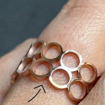 Nahaufnahme einer Hand, die einen goldenen Ring mit einem Wabenmuster trägt; ein Pfeil zeigt auf eine Vertiefung auf der Haut, die durch das kreisförmige Muster des Rings verursacht wird.