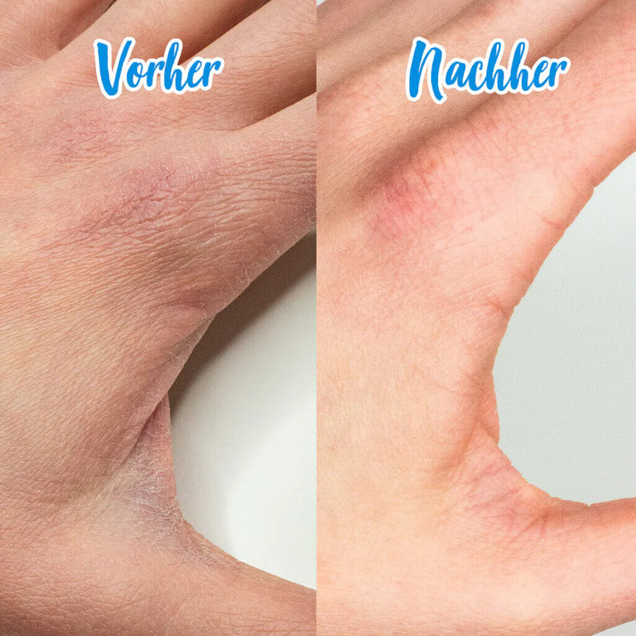 puremetics Handpflegeseife "Natron Repair" 80 g